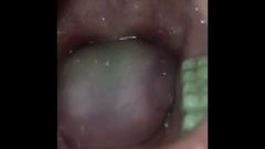 Thai Girl,s Uvula