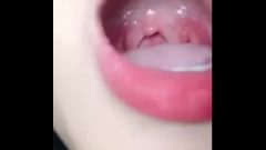 Chinese Girl,s Uvula