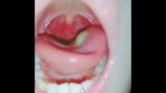 Asian Girl’s Uvula